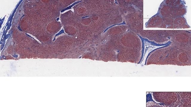 Лимфатический узел смотреть онлайн