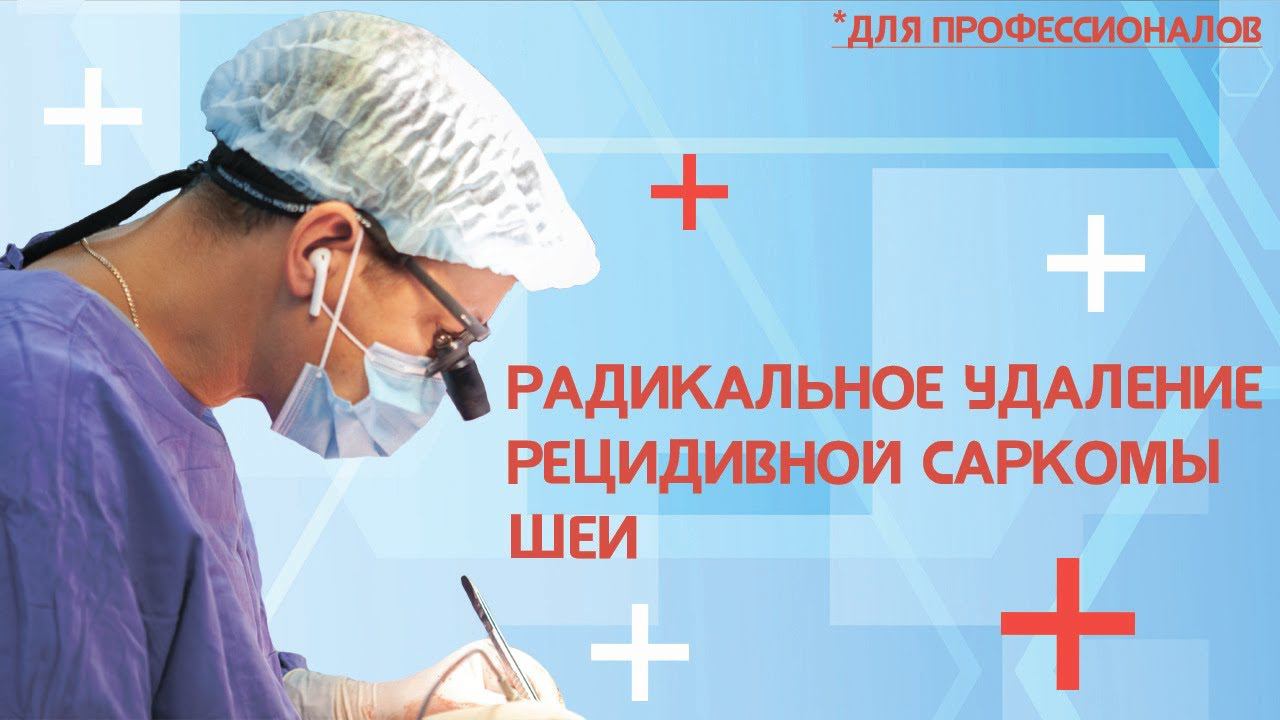 Радикальное удаление рецидивной саркомы шеи с протезированием сонной артерии (для профессионалов)