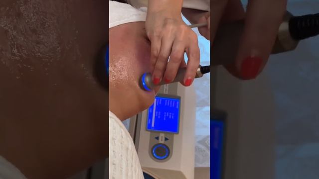 ЛУЧШИЙ ЭКСПРЕСС-МЕТОД! | ЛДМ массаж в Бьюти Бриз смотреть онлайн