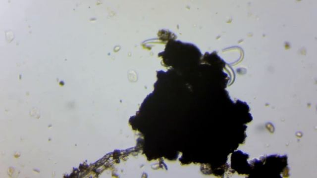 Тихоходка, нематоды и инфузории под микроскопом смотреть онлайн