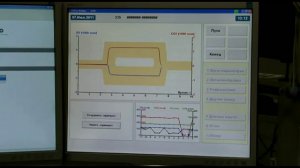 Тредмил-тест.