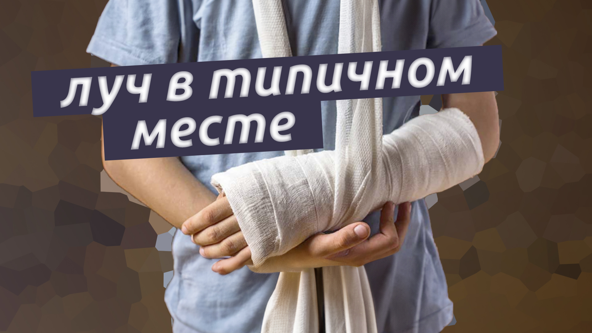Реабилитация после операции луча в типичном месте смотреть онлайн
