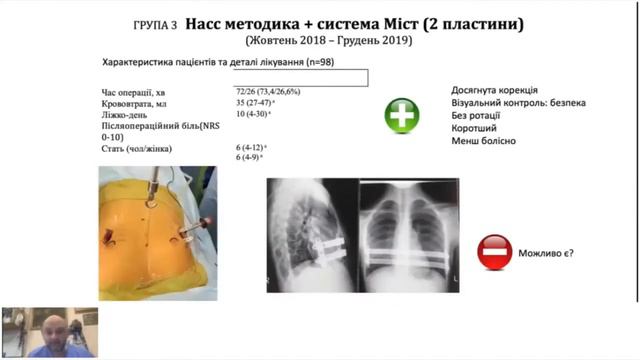 Малоінвазивна реконструкція лійкоподібної деформації грудної клітки смотреть онлайн