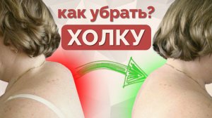 Как убрать вдовий горб? Упражнения от холки.