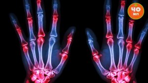 Вредно ЛИ ХРУСТЕТЬ ПАЛЬЦАМИ? \\\ Мифы и ФАКТЫ