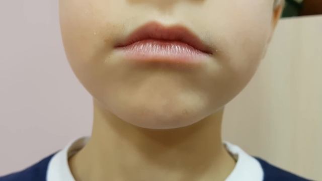 Короткая уздечка языка и звук Р. Ставим одноударный звук Р. Часть № 2 смотреть онлайн