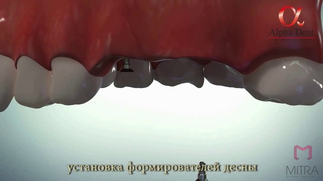 3D анимация и компьютерная графика - медицина.