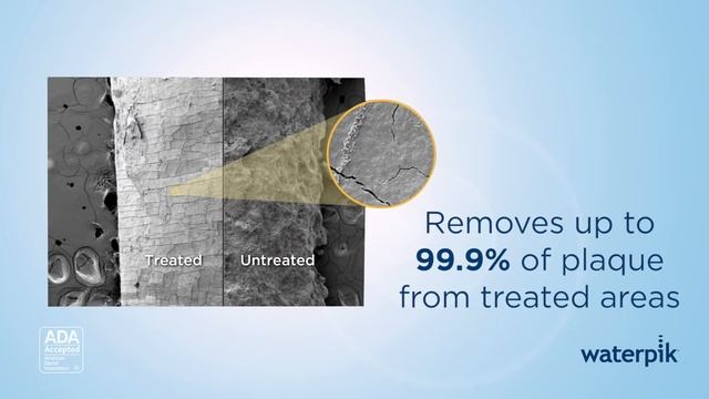 American Dental Association (ADA) Seal of Acceptance - The Waterpik™ Water Flosser смотреть онлайн