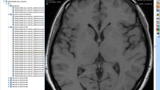 MicroDicom - Free DICOM Viewer (version 0.0.1)