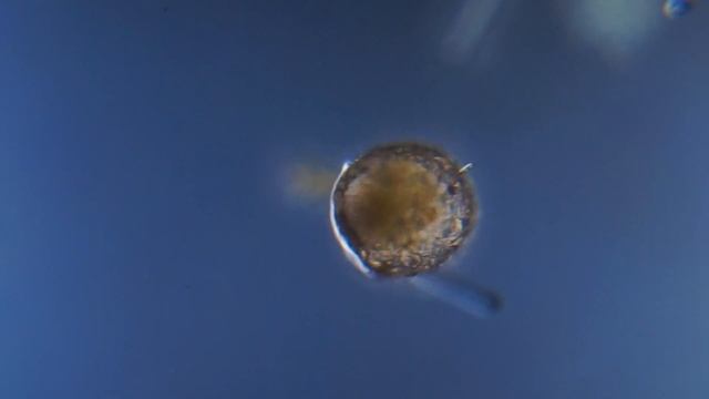 Панцирная амеба под микроскопом. смотреть онлайн