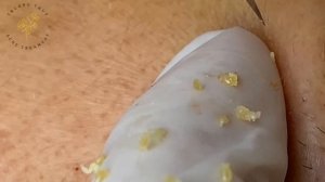 Satisfying Relaxing with Sac Dep Spa Video (#166)