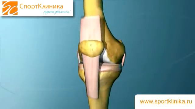 Коллатеральные связки - СпортКлиника смотреть онлайн
