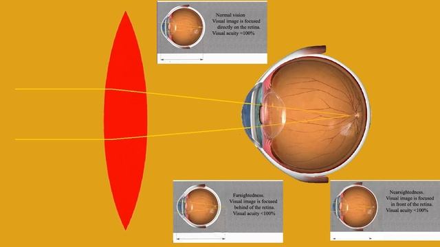 Eye Lens смотреть онлайн