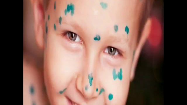 Ветерянка у 14-15 летних смотреть онлайн