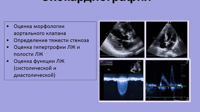 14-03-22 Енисеева ЕС Клапанные пороки сердца.mp4