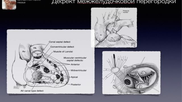 ВПС-3 смотреть онлайн