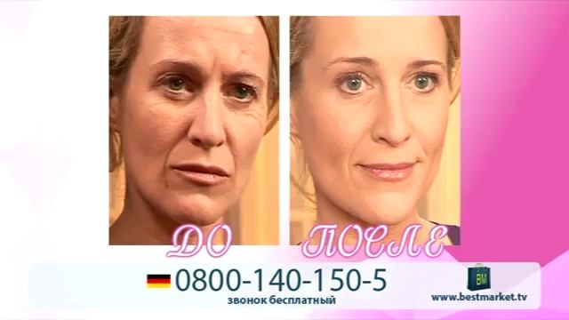 Wrinkle Fillers