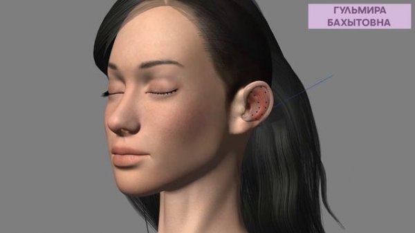 Отопластика