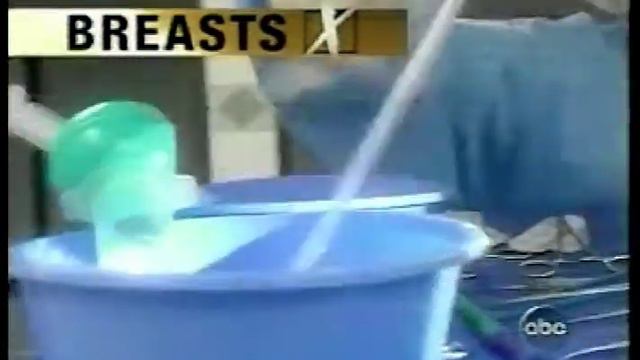 Extreme Makeover | Dr. Garth Fisher Performs a Breast Augmentation and Liposuction on Amy Romaines смотреть онлайн