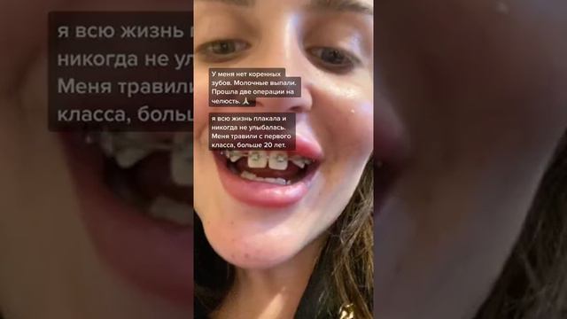 НЕ УЛЫБАЛАСЬ БОЛЬШЕ 20 ЛЕТ🥺😭 смотреть онлайн