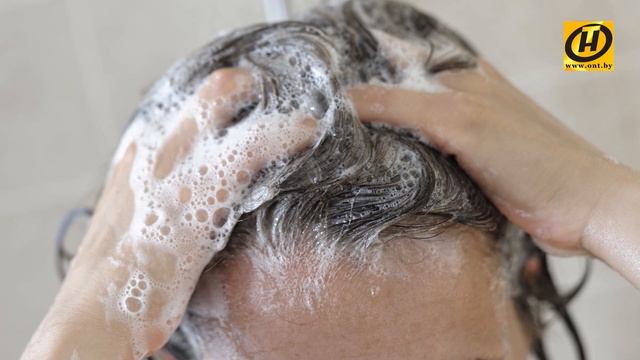 Перхоть. Как лечить? Формула здоровья. смотреть онлайн