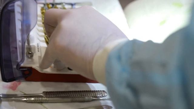 Чудо в стоматологии за два часа…во сне… смотреть онлайн