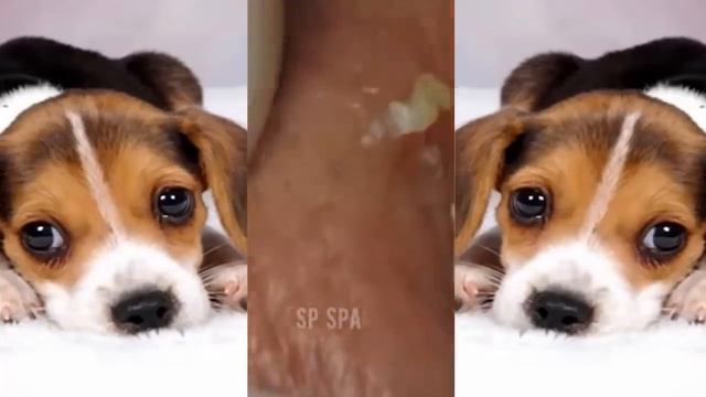 Relax squeezing out blackheads #61 Черные точки смотреть онлайн