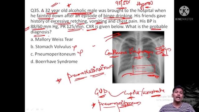 FMGE DEC 2021 l MEDICINE TEST AND DISCUSSION (CNS + GIT) Part 3 смотреть онлайн