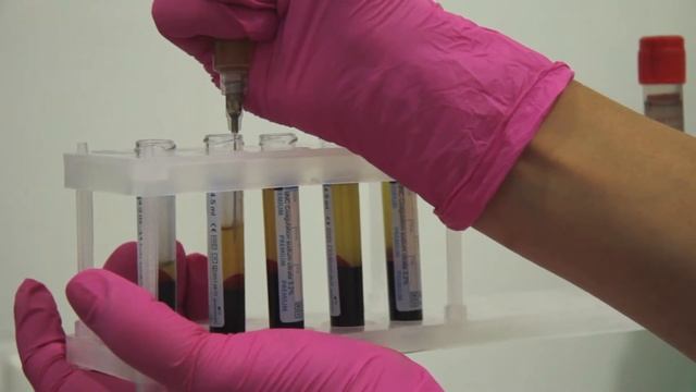 Всем купон. Биоревитализация и плазмолифтинг от медицинского центра "Майстерня поcмішки та краси" смотреть онлайн