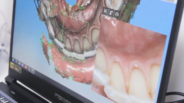 2022 - EPSON Moverio BT 40s Use case + Dexis CS 3800 WiFi Studio Dentistico Radaelli смотреть онлайн