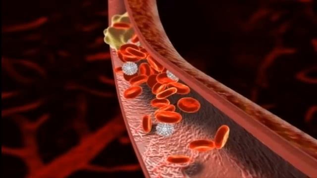 ЧЕМ ОПАСЕН ДЕФИЦИТ КРЕМНИЯ В ОРГАНИЗМЕ? Продукты,содержащие кремний смотреть онлайн