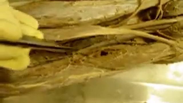 топографическая анатомия нижней конечности смотреть онлайн