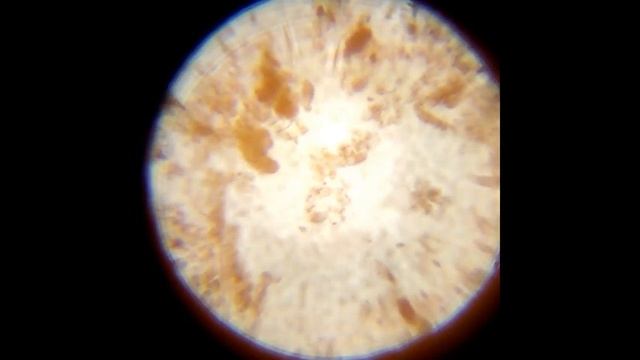 активный ил под микроскопом