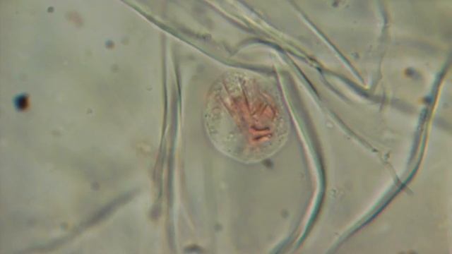 Живая клетка мякоти арбуза под микроскопом смотреть онлайн