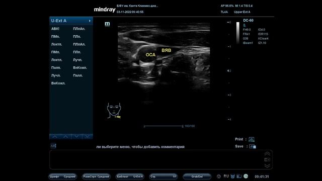 Основы ультразвуковой анатомии сосудов головы и шеи для студентов смотреть онлайн