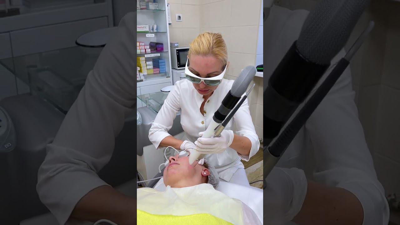 4D лазерное омоложение FOTONA смотреть онлайн