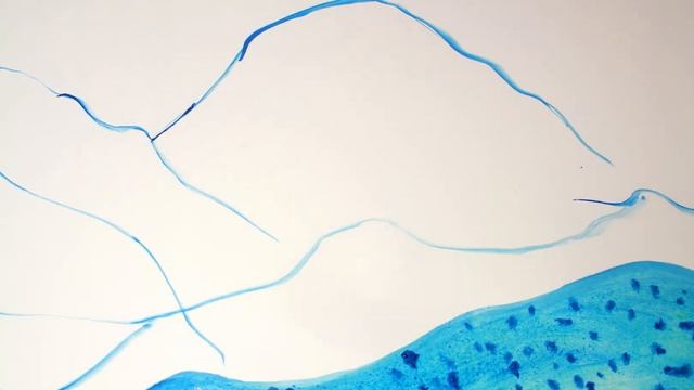 Пальто из Ваты - Серебряная свадьба - клип