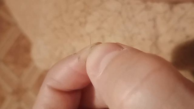 Нанороботы живут в нас. Живая съёмка извлечения "живого волоса" Маргелона. смотреть онлайн