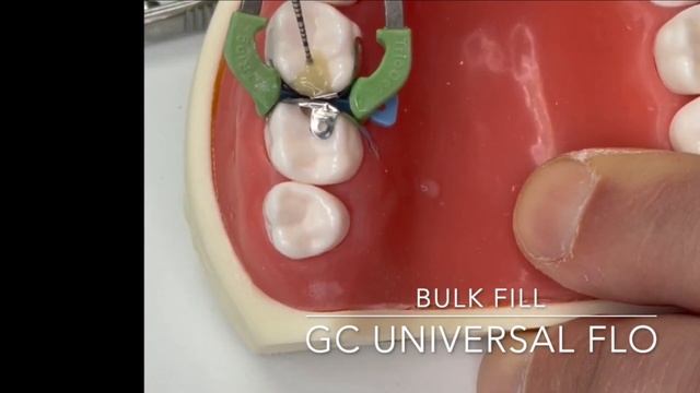 Blocky Tips 01 - Back-to-back Class 2 Composites смотреть онлайн