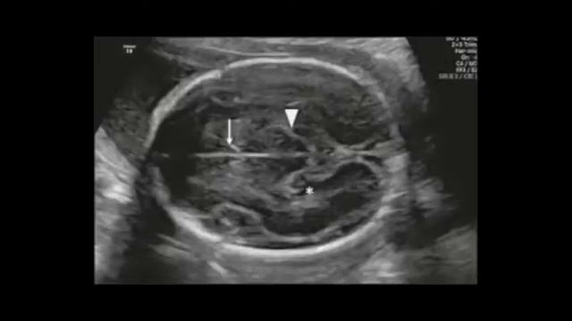 Дуа слушать во время беременности каждый день и  ребенок родится здоровым ин шаа'Аллах ❤️