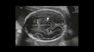 Дуа слушать во время беременности каждый день и  ребенок родится здоровым ин шаа'Аллах ❤️