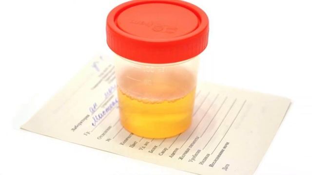 Моча у новорожденного.Норма мочи у ребенка смотреть онлайн