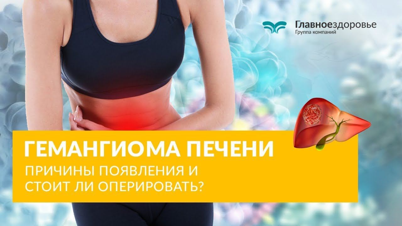 Гемангиома печени. Причины появления и стоит ли оперировать? смотреть онлайн