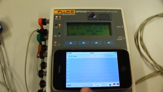 A Real-Time Wavelet-Based Electrocardiogram Delineation System смотреть онлайн