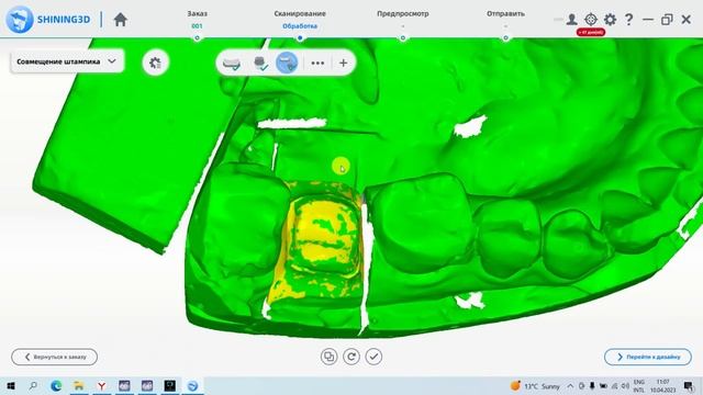 EXOCAD С 0 ДО PRO | УРОК 2: РАБОТА СО СКАНЕРОМ смотреть онлайн