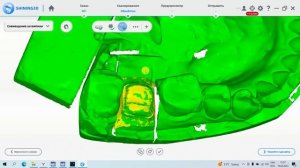 EXOCAD С 0 ДО PRO | УРОК 2: РАБОТА СО СКАНЕРОМ