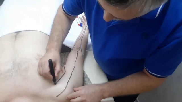 Синдром компьютерной мыши смотреть онлайн