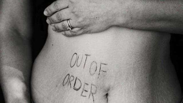 Сальмонеллёз / SALMONELLOSIS