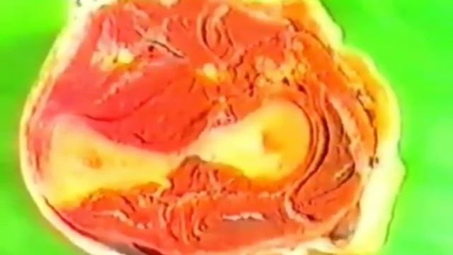 ОБЛАСТЬ ПРЕДПЛЕЧЬЯ   ДВГМУ