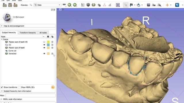 Surface Segmentation Demo